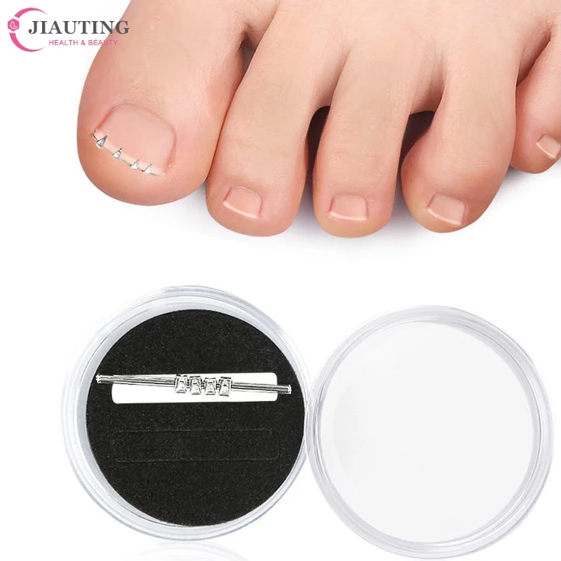 เครื่องมือแก้ไขเล็บเท้าเหล็กคุดที่มองไม่เห็นคลิปหนีบยืดได้1ชิ้น