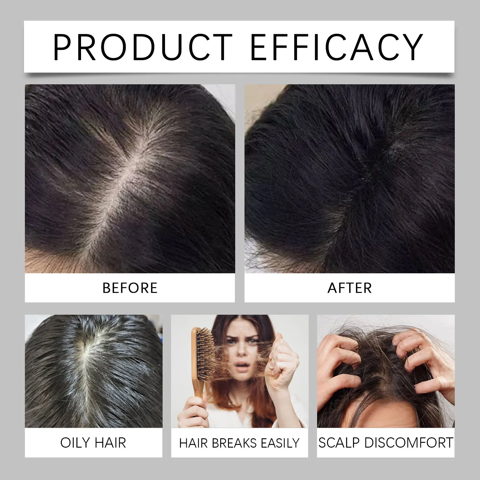 Polygonum Multiflorum Hair Care Spray Biotin Nourishes Scalp Strengthens Hair Roots Smoothing Hair Care Essence Conditioner - view 4