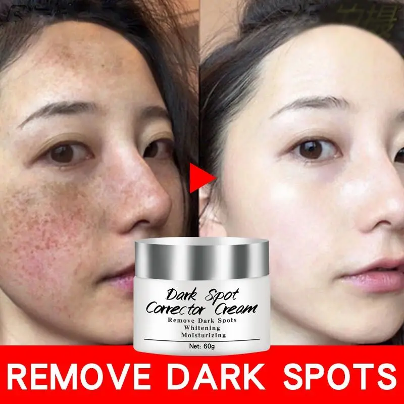 Newest Dark Spots Corrector Cream Whitening Facial Cream Repair Fade Freckles Remove Dark Spots Melanin