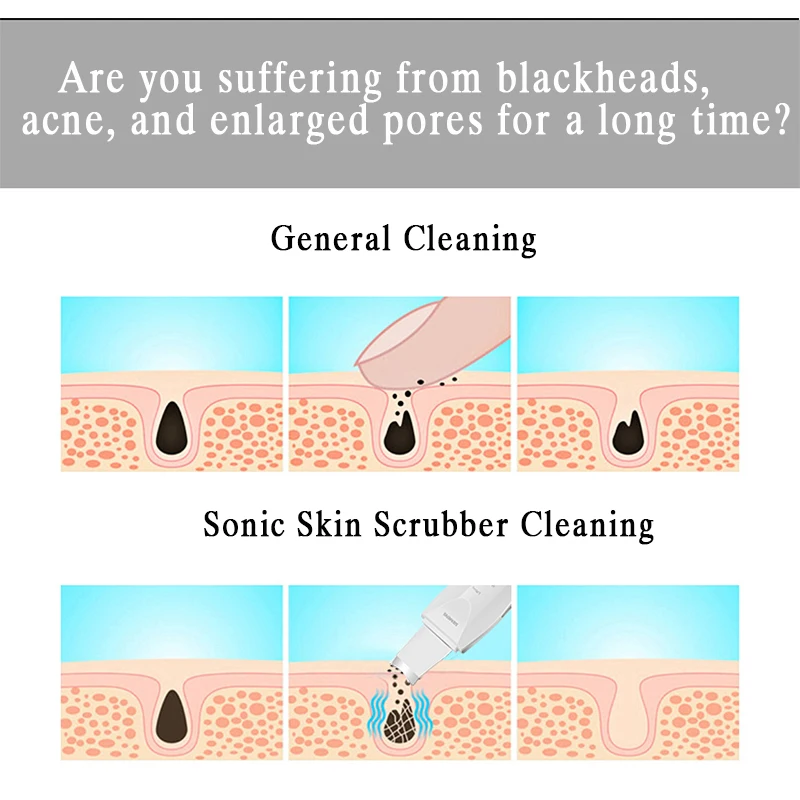 อัลตราโซนิกทําความสะอาดใบหน้าลึกสิ่งสกปรก สิวหัวดํา เครื่องขัดผิว เครื่องสกัดผิวลอก ลดจุดด่างดํา ริ้วรอยบนใบหน้า ลบ