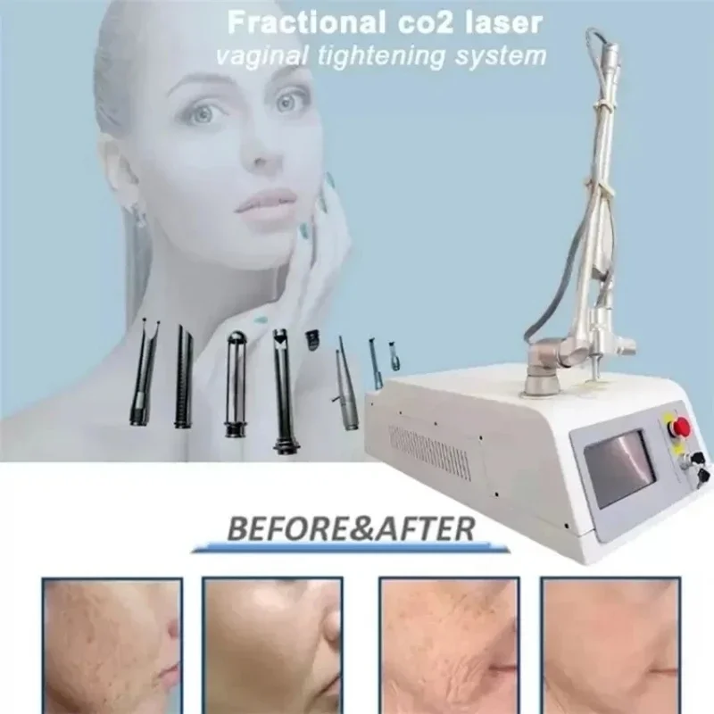 2024 New Portable CO2 Monitoring Score Iaser Skin Tightening Scar Removal Facial Pigmentation Wrinkles Scar Acne Scar Removal