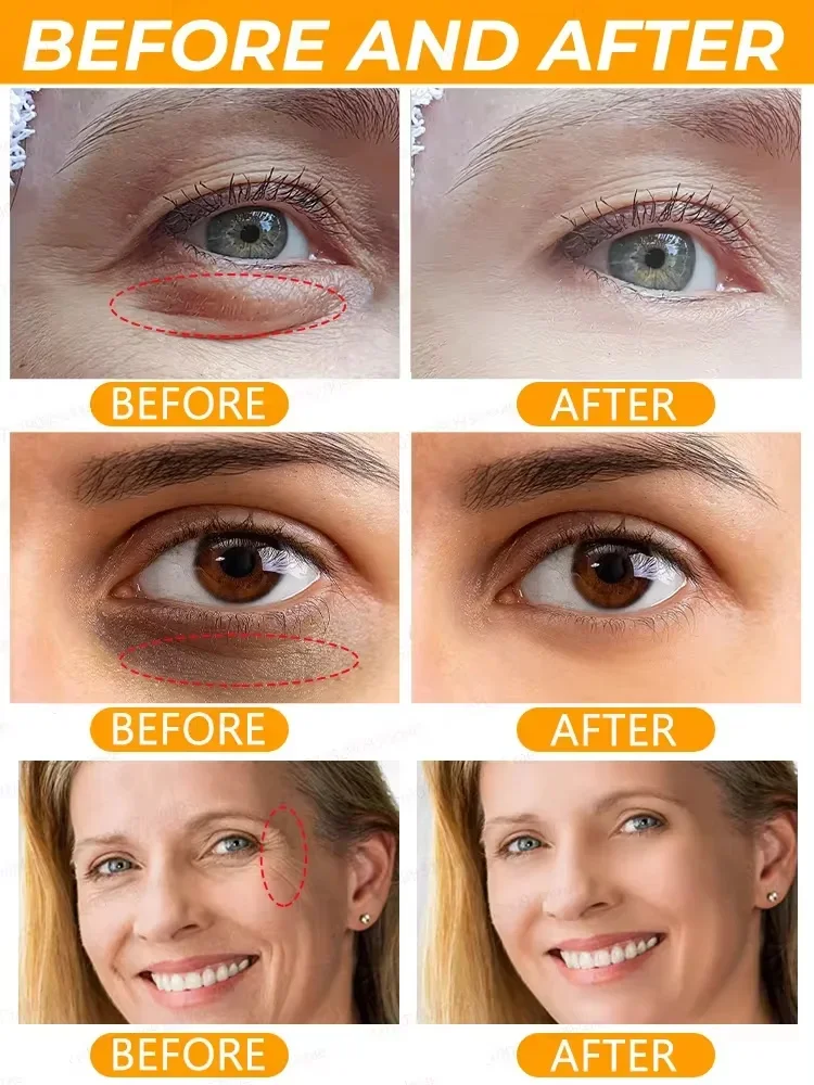 Collagen Dark Circle Remove Eye Cream Anti wrinkle Firming Fade Fine Lines Eye Bag Anti Puffiness Roll-on Eye Skin Care Products