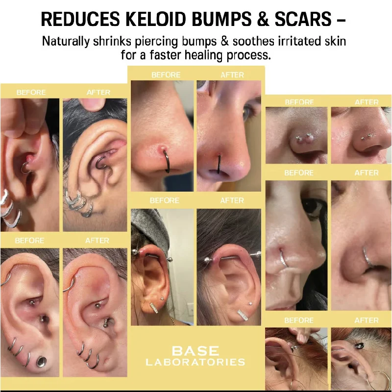 

Увлажняющая отшелушивающая сыворотка. Увлажняющая эссенция. Нежно отшелушивает, блокирует увлажнение и осветляет тусклую кожу.