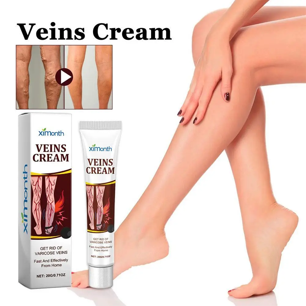 Crema per trattamenti delle vene efficace per alleviare le gambe vasculite dilatata flebite Formula naturale unguento per vene Varicose