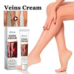 Vein Treatments Cream Effective Relieve Legs Dilated Vasculitis Phlebitis Natural Formula Ointment For Varicose Veins