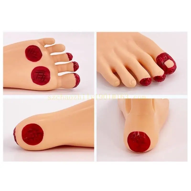 Diabetic Foot Nursing Simulator Model Diabetic Foot Care Training Model，Nursing，Medicals Teaching Tool for Teaching Practice