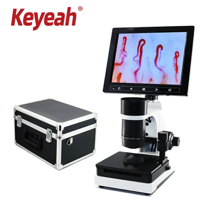 Nailfold Capillary Microcirculation Detector Blood vascular HD Capillary Microscope machine TV AV USB 7/8/9/10.1\'\'LCD