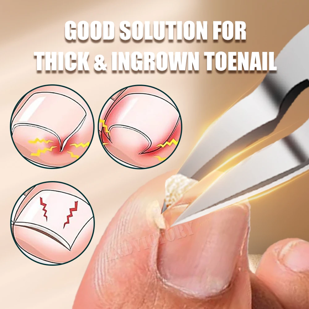 Toe Nail Clippers Nail Correction Thick Nail Ingrown Toenails Nippers Dead Skin Nail Art Pedicure Care Plier Cutter Scissor Tool