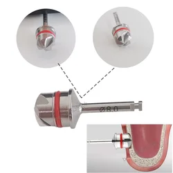 1Piece Dental Lateral Approach Sinus Lift Creat Window Implant Reamer Dome Drill
