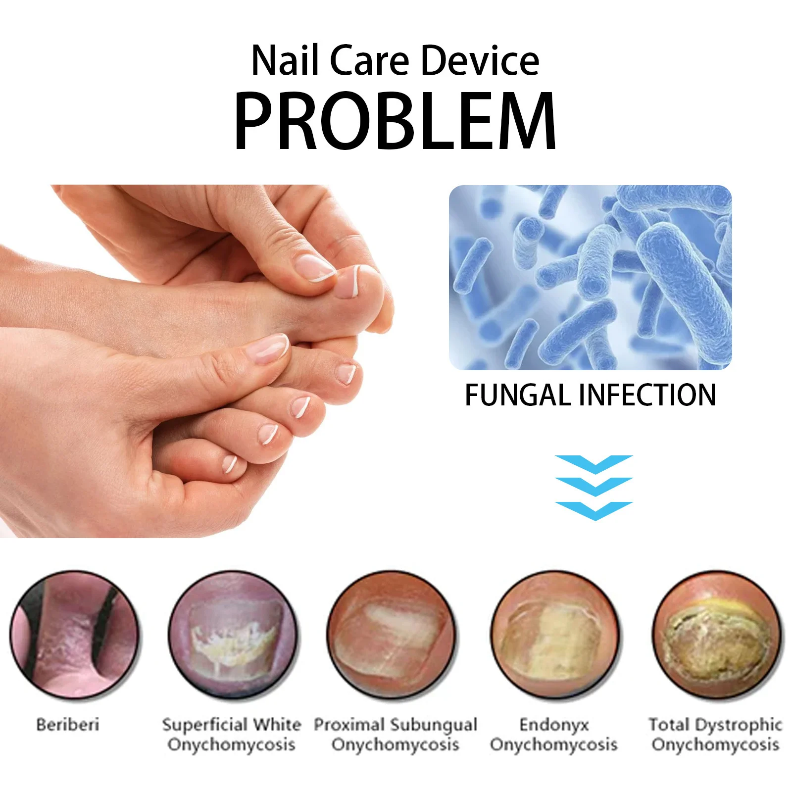 Nail Fungus Cleaning Device for Damaged Discolored Thick Toenails & Fingernails Nail Fungal Infection Remedy LED Light Device