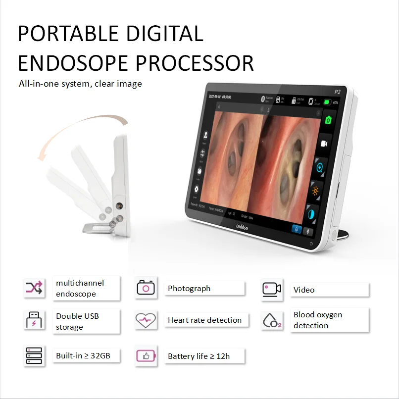 Endoso 12.1 Inch Portable Endoscopic cam era System HD For Bronchoscopy Ureteroscopy Choledochoscopy Cystoscopy Surgery