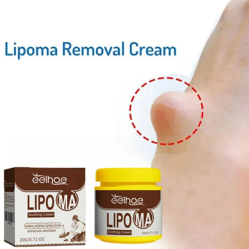 Creme calmante para removedor de caroços, tratamento remédio líquido, aplicar no inchaço da pele, celulite, fibroma, gordura massa gesso