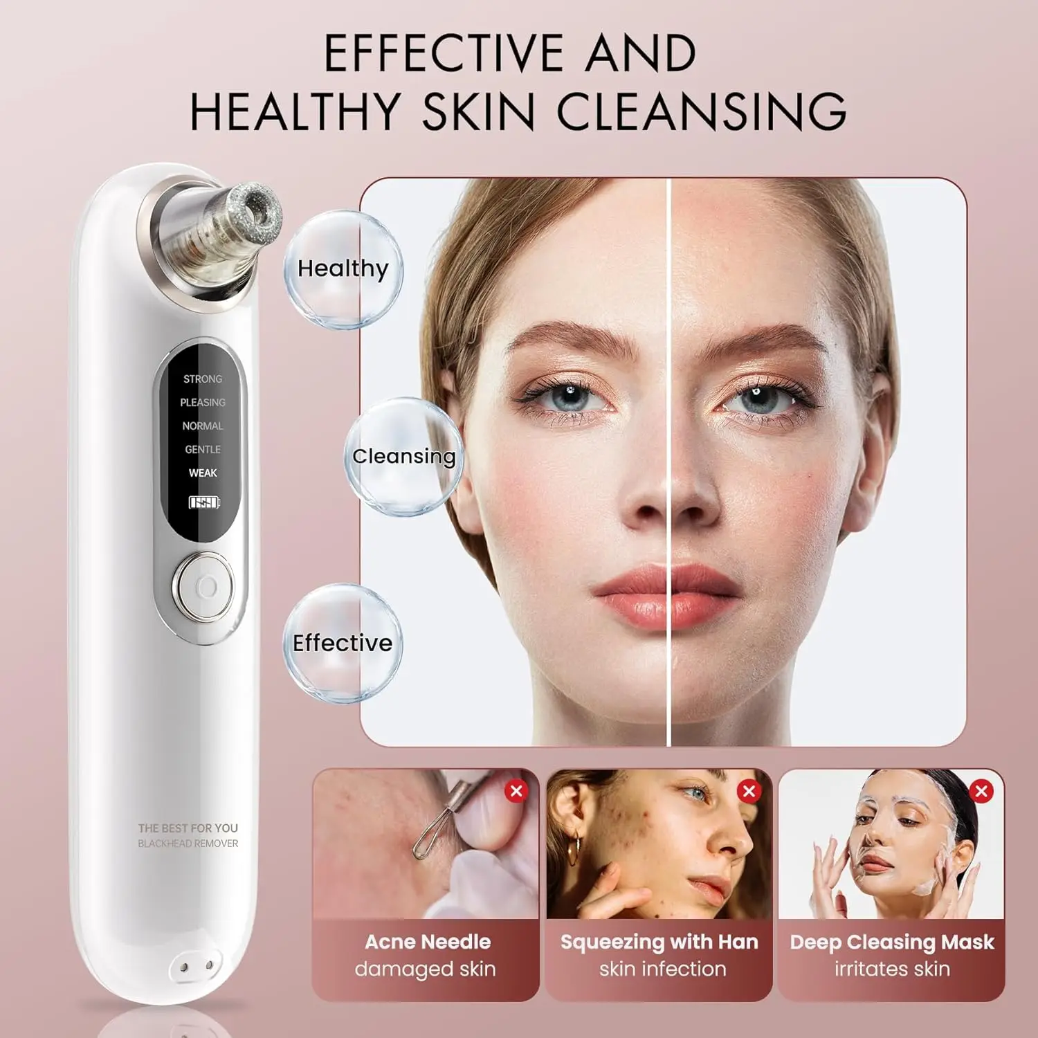 Comedondrukker Vacuüm Acne Cleaner Mannen Vrouwen Pore Extractor Draagbare USB Oplaadbare 5 niveaus 4 tips Gezichtsmee-eter verwijderen