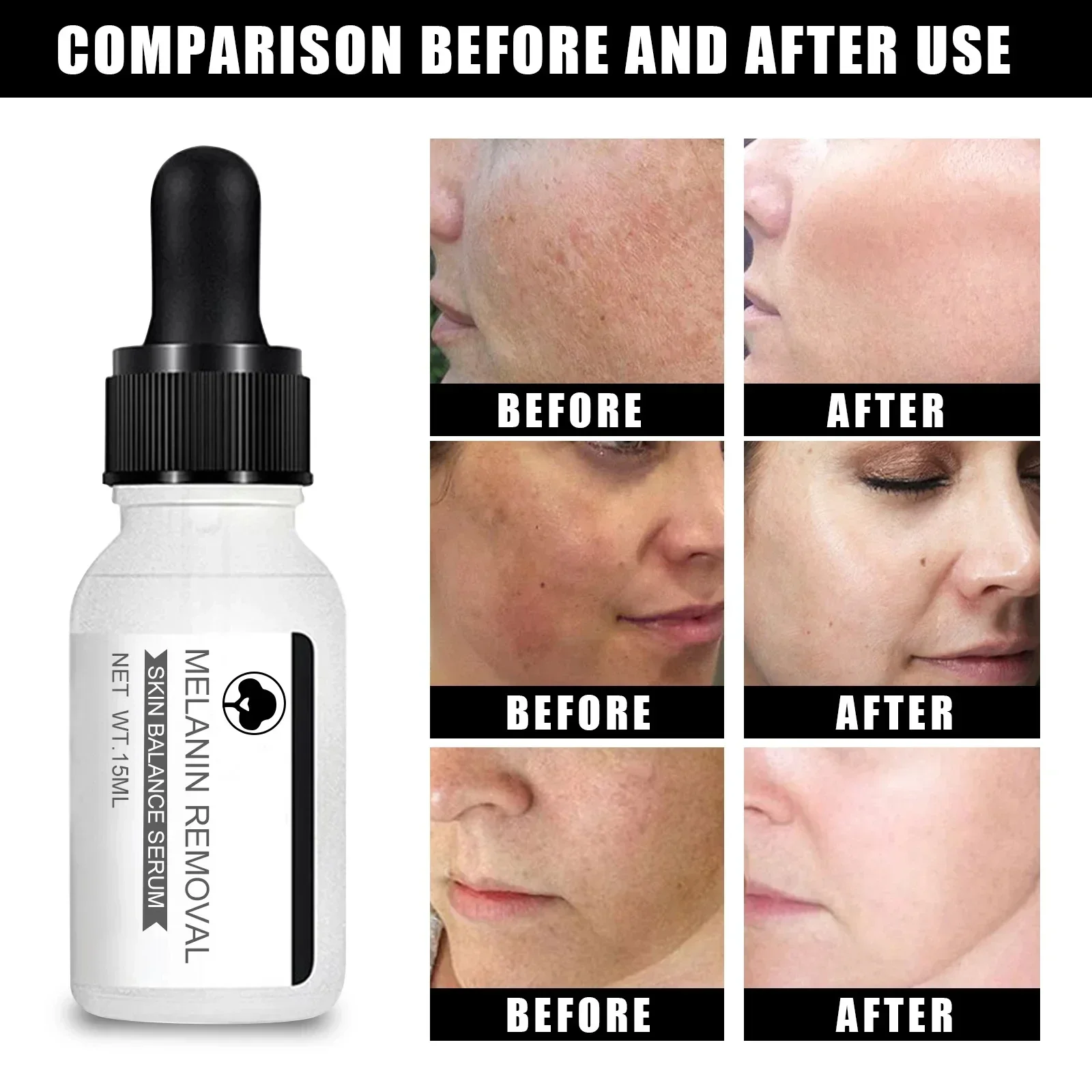 Niacinamide Donkere Vlek Verwijderen Serum Anti-Aging Heldere Sproet Witter Huid Crème Vervagen Pigmentatie Melasma Vocht Gezicht Huidverzorging