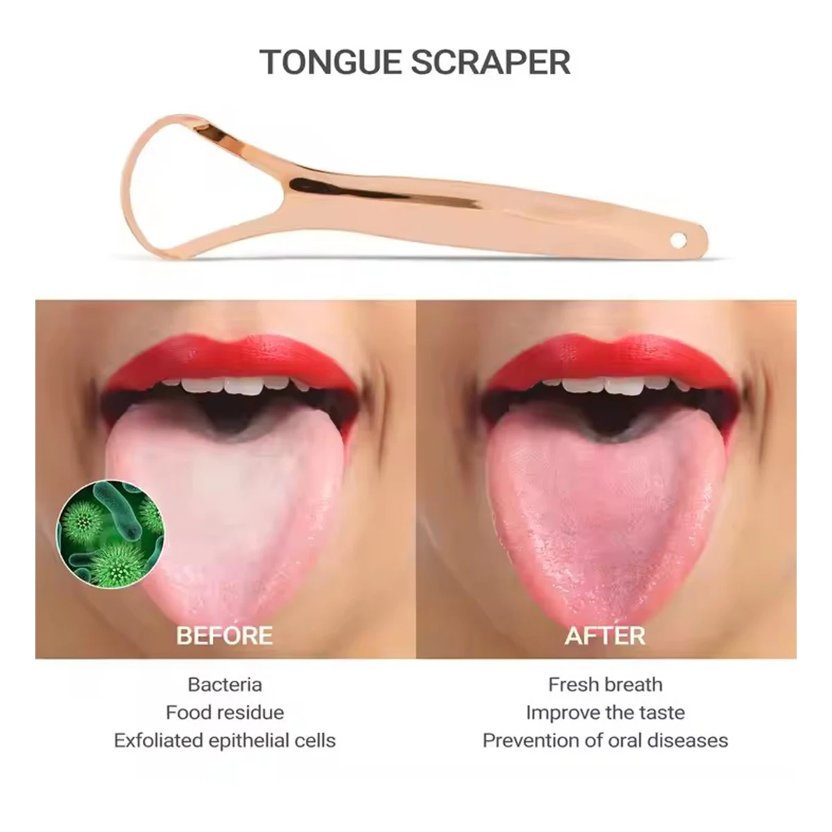 Thumbnail 2 - #50 Tongue Scrapers Comparison Guide