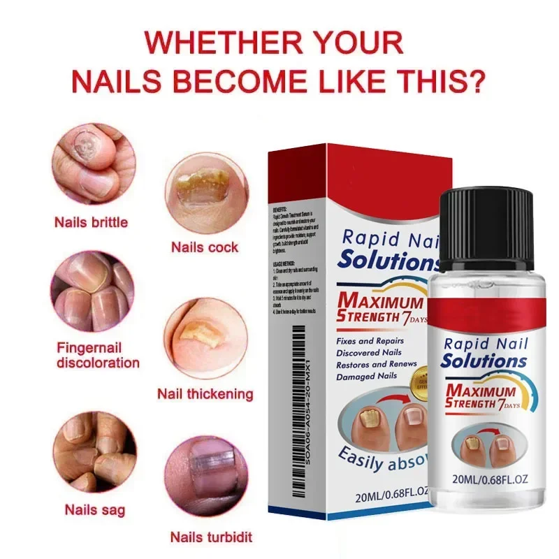 1/2/5 шт. эссенция для ухода за ногтями-жидкость для восстановления пожелтения и утолщения седых ногтей рук и ног увлажняющая жидкость для ногтей 20 мл