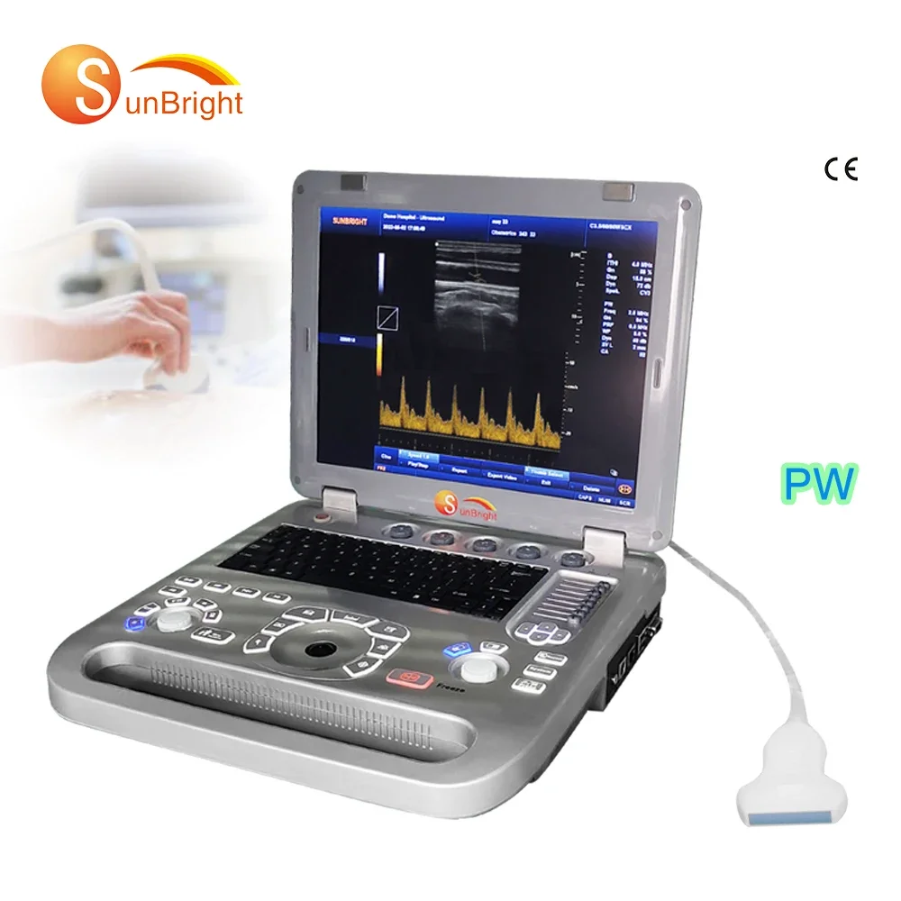 High Quality Laptop SUN-800F1 PW Ultrasound Machine