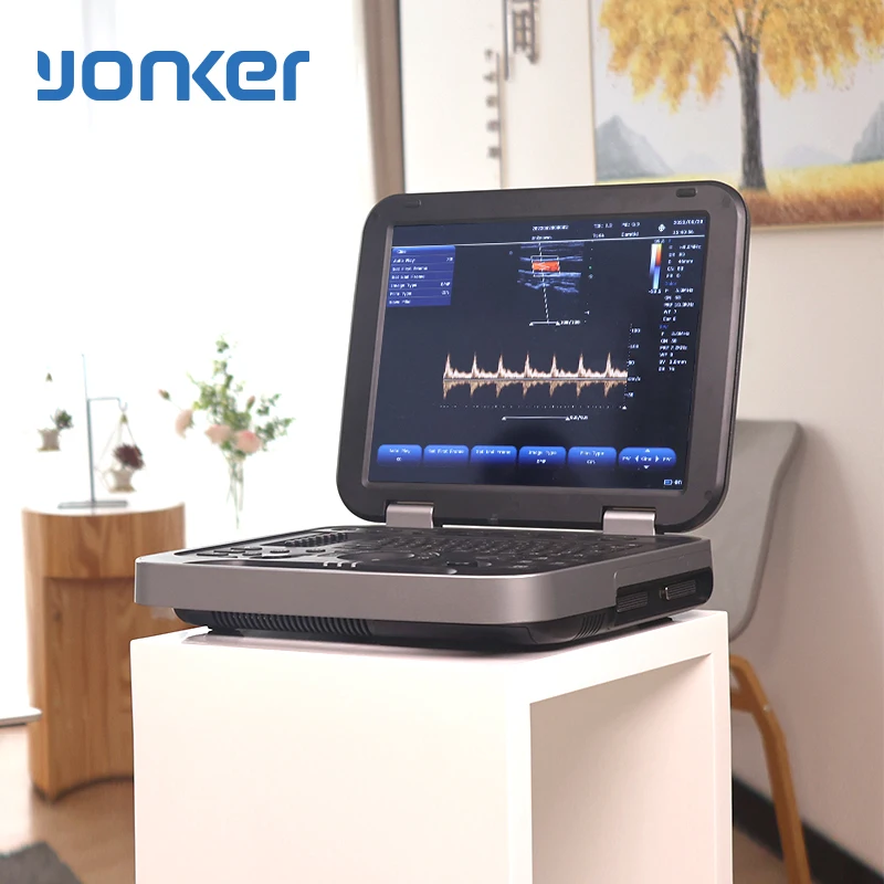 Yonker Hospital Equipment Echocardiography Machine Echography Portable Color Doppler Ultrasound Machine