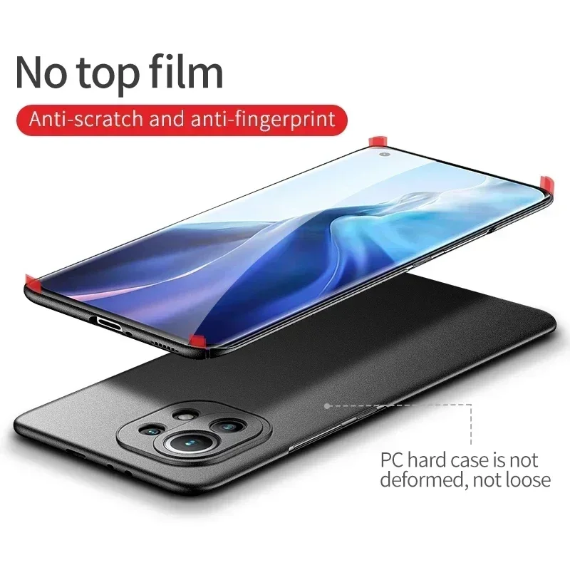 Funda Xiaomi Mi 11 Lite, cubierta mate ultrafina para Xiaomi Mi 10, 10i, 10T, 11X, 11T, 11i, 11 Pro, Ultra Lite, 5G, NE