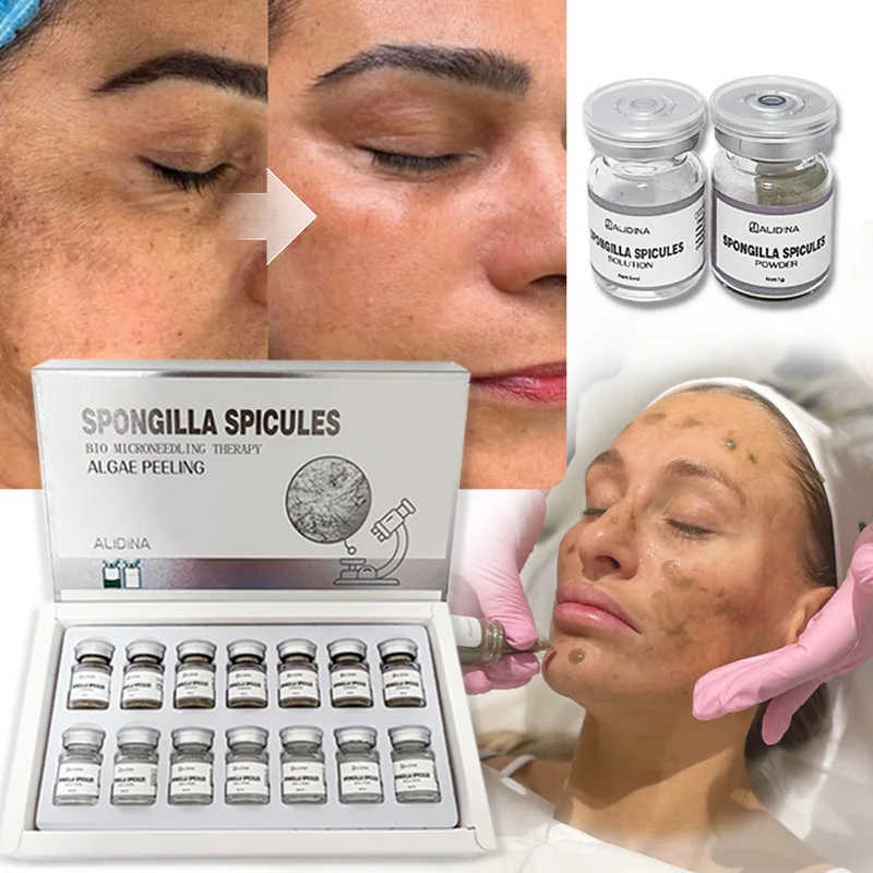 ZS Efectivo Spongilla Spicules Bio Peeling Algas Peeling Peel Verde Esponja Hidrolizada Polvo para Acné Melasma Hyperpigmentación