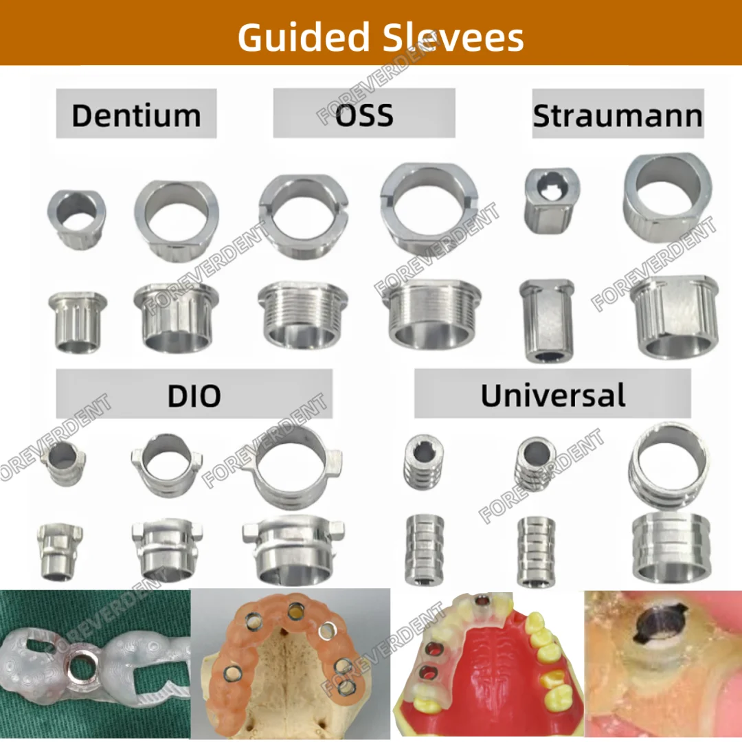 10pcs Dental Digital DIO Guided Sleeves Digital Implan Planning Template Drill Position 11Sizes