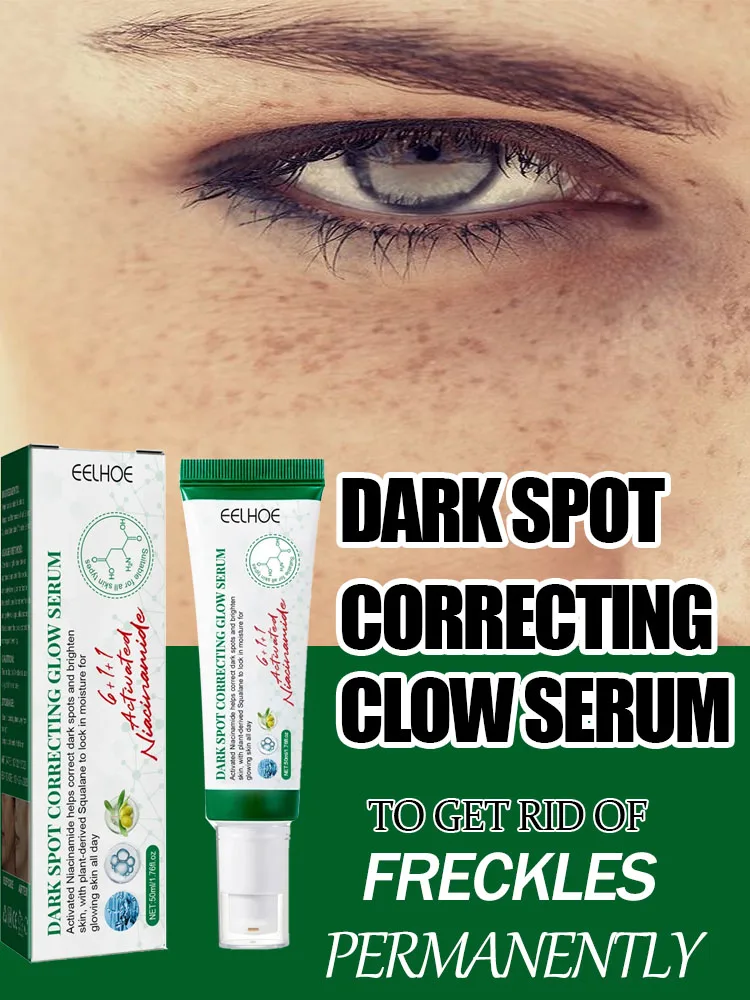 Dark Spot Removal Serum Remove Melasma Fade Pigmentation Brighter Chloasma Sun Spot Remover Anti Aging Whitening Sprout Cream