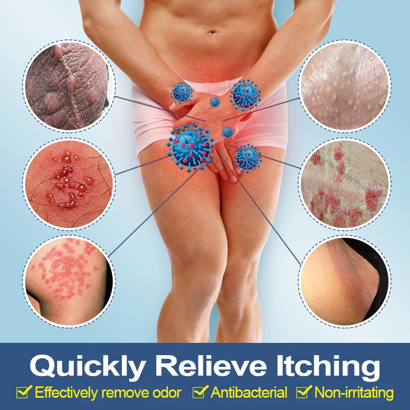 1pcs Privates Antibacterial Cream Scrotal Eczema Tinea Cruris Fungal Infection Psoriasis Cream Vulva Odor Antifungal Cream G038