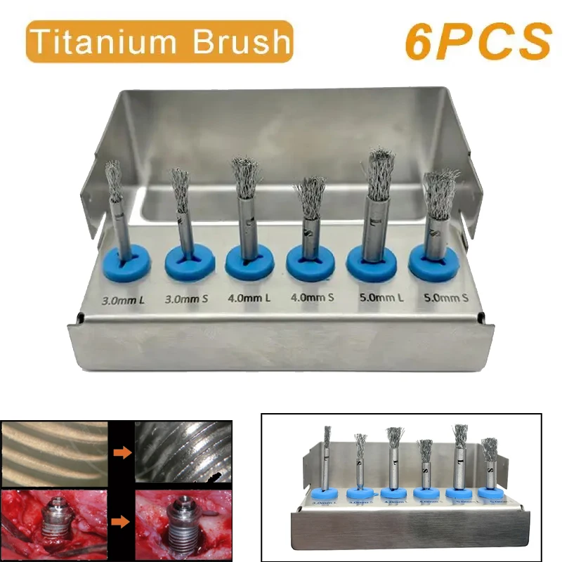 6pcs Dental Fixture Cleaning Brush Dental Implant Surface Cleaning Brush Peri-Implantitis Threads Tool Dental Titanium Grade 5