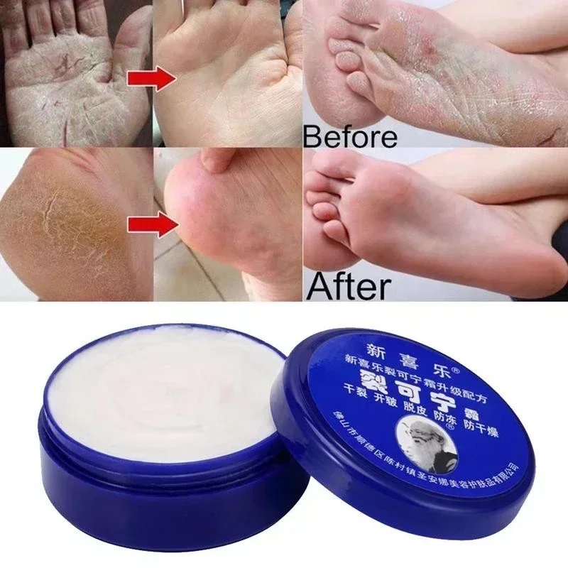 Herbal Anti Crack Foot Cream, Óleo anti-secagem, Reparação do calcanhar rachado, Remover a pele ruim, Máscara de cuidados com os pés da mão