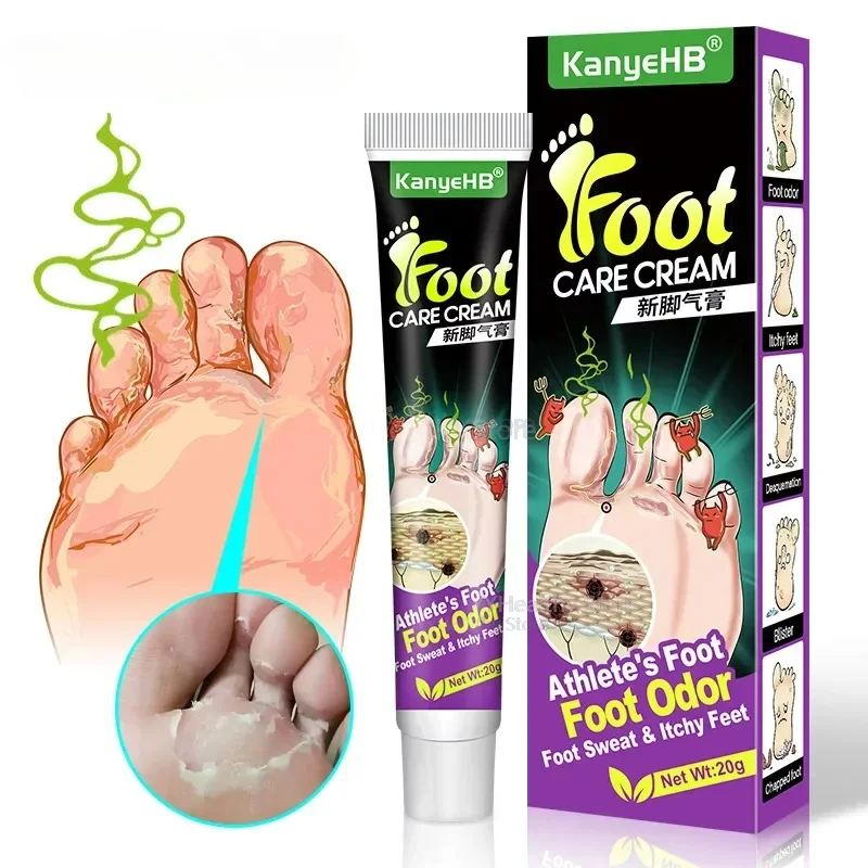 

네일 Foot Care Tools KanyeHB Foot Ointment Feet Odor Care Cream Feet Skin Topical Cream Masajeador De Pies علاج الاسترخاء