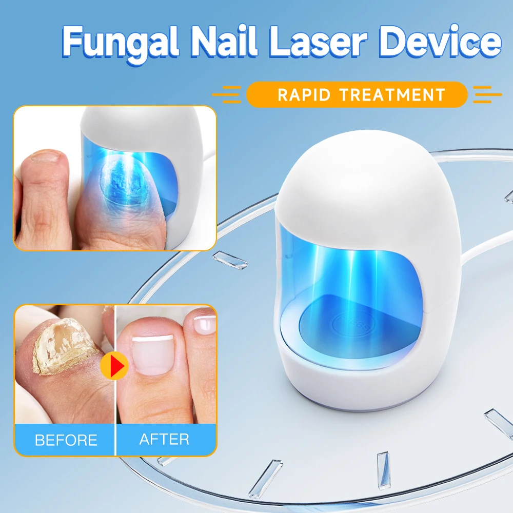 Nail Fungus Cleaning Device for Damaged Discolored Thick Toenails & Fingernails Nail Fungal Infection Remedy LED Light Device