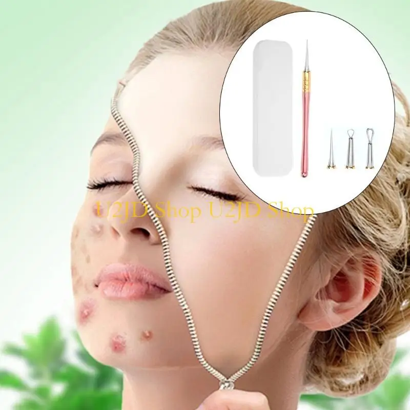 U2JD 3 in 1 acnes gereedschapset voor Blackhead en Pimple Removal met precieze pincet