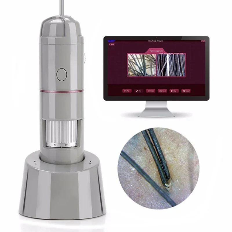 free shipping Skin analyzer/hair analyzer/pigment precipitation analysis/can be connected to the printer Support analysis