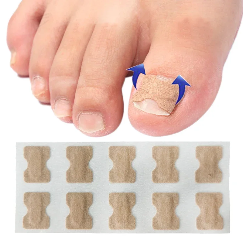 10Pcs/50Pcs Nail Art Ingrown Correction Sticker Foot Care Pedicure Tool Fixer Paronychia Recover Toenail Elastic Patch Corrector