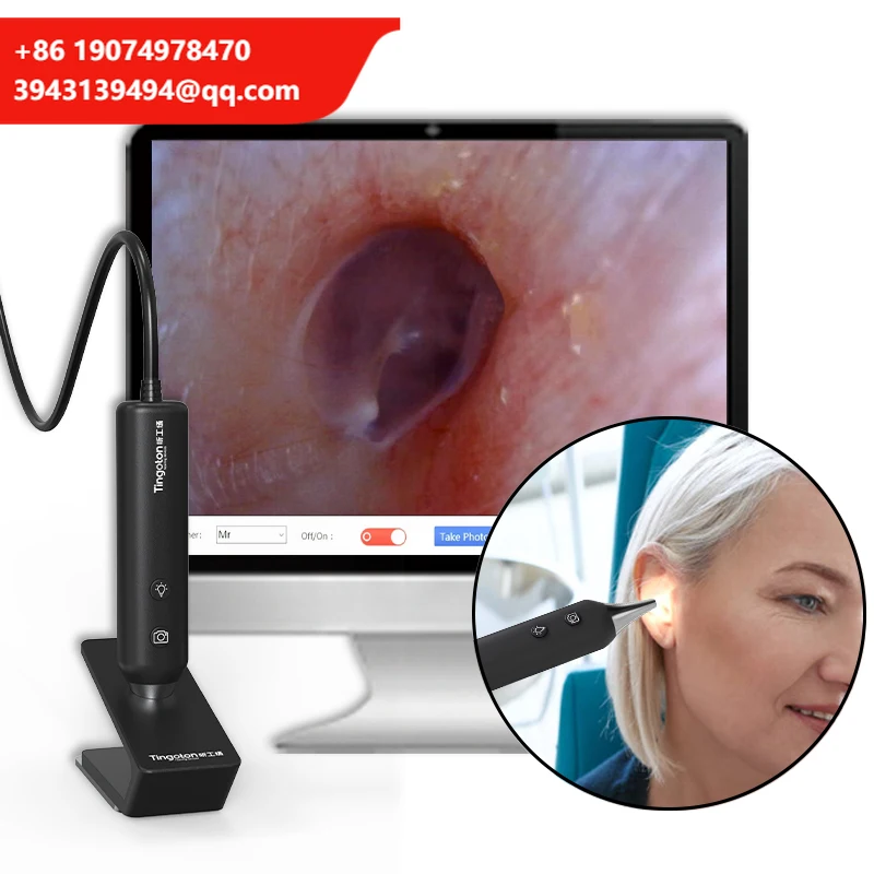 Tingoton Black/White Digital Endoscope Camera Ear Video Nasal Endoscope USB3.0 1280x720 30FPS Adjustable LED Light Source