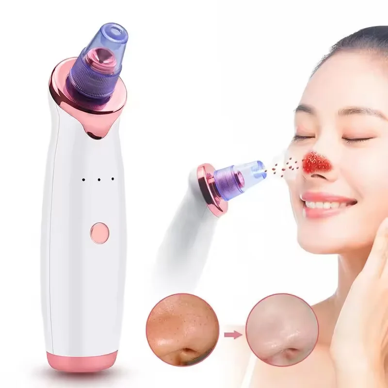 Hot Sale Skin Care Portable Rechargeable Vacuum Blackhead Remover Anti Aging Anti Wrinkle Tightening Skin Care Blackhead Removal