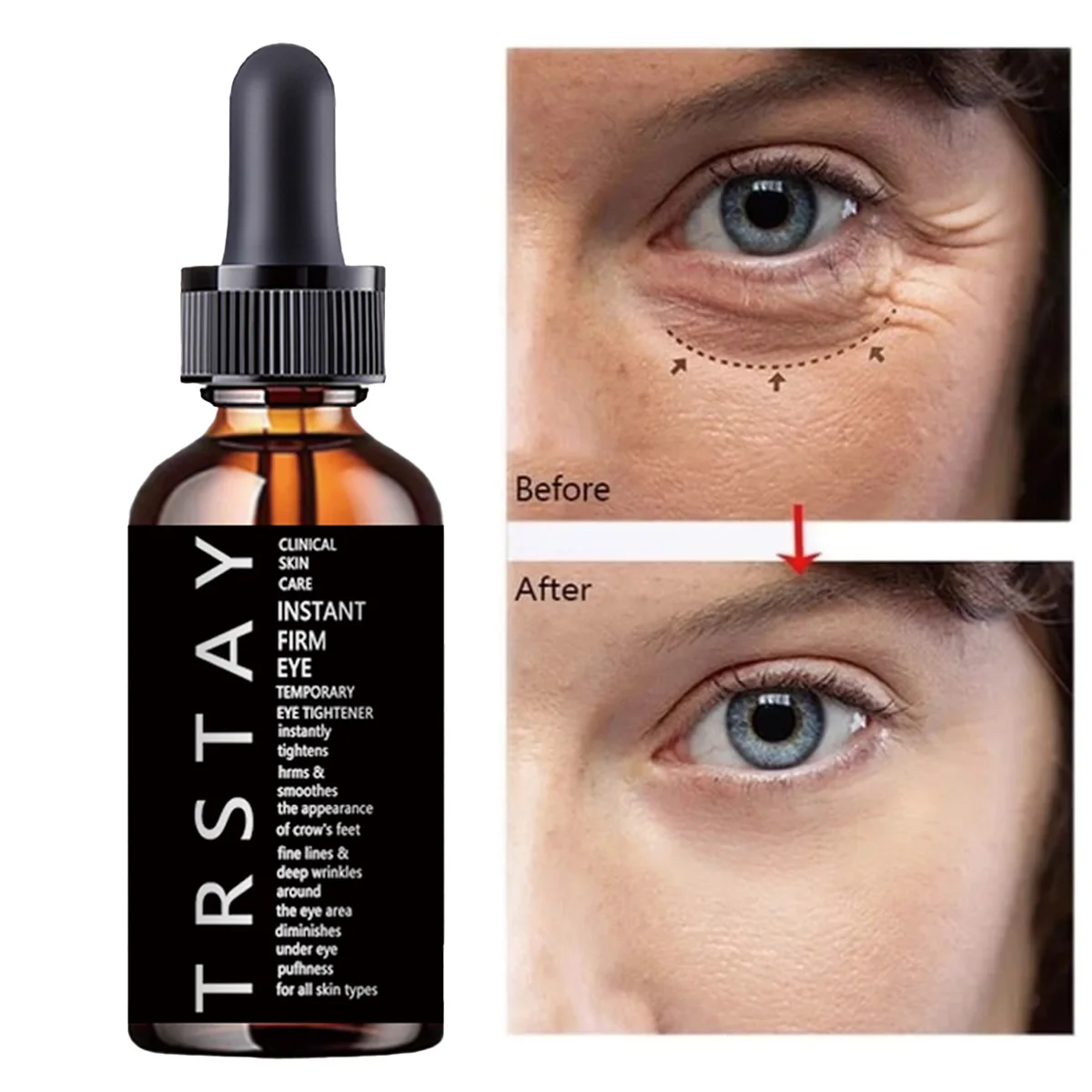 

TRSTAY Eye Essence Уход за кожей Подтяжка Увлажняющий защитный барьер Восстанавливающая сыворотка для глаз для мам и детей