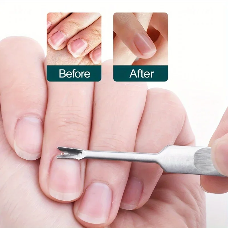5個入りステンレス製キューティクルトリマーセット、爪と足の爪の端の角質除去、プラスチック製収納ケース付き、ポータブルマニキュアキット