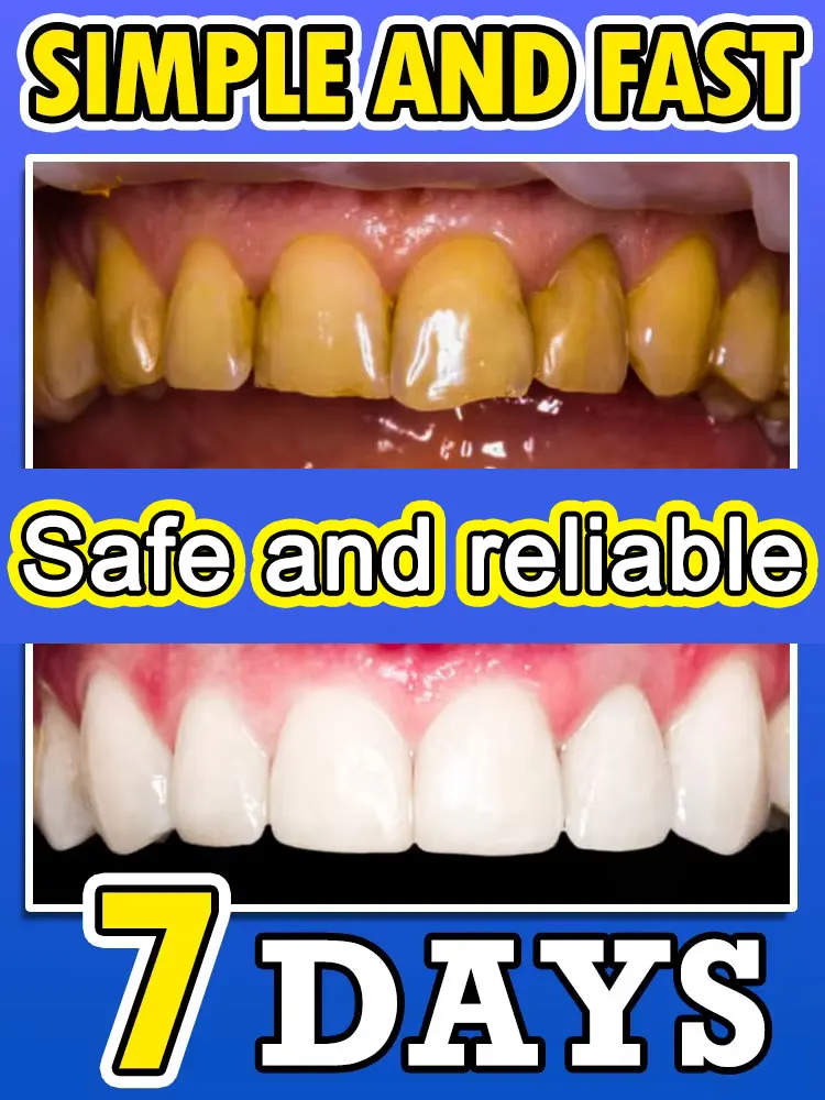 

Repair tooth decay
