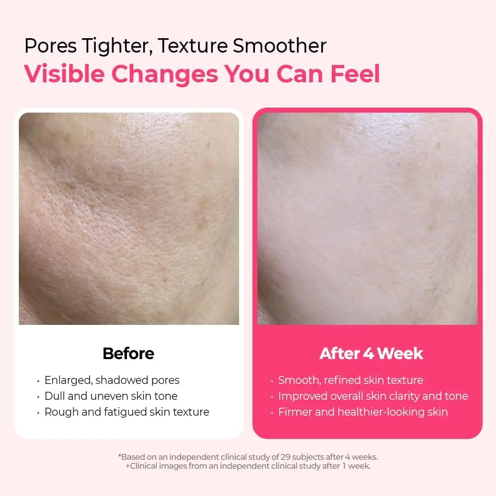 Skincare Dr.Melaxin Soro Cemenrete Cyano Pink Spicule com Cálcio, aperto dos poros refina os poros soro de aperto 1,01 fl. onças.