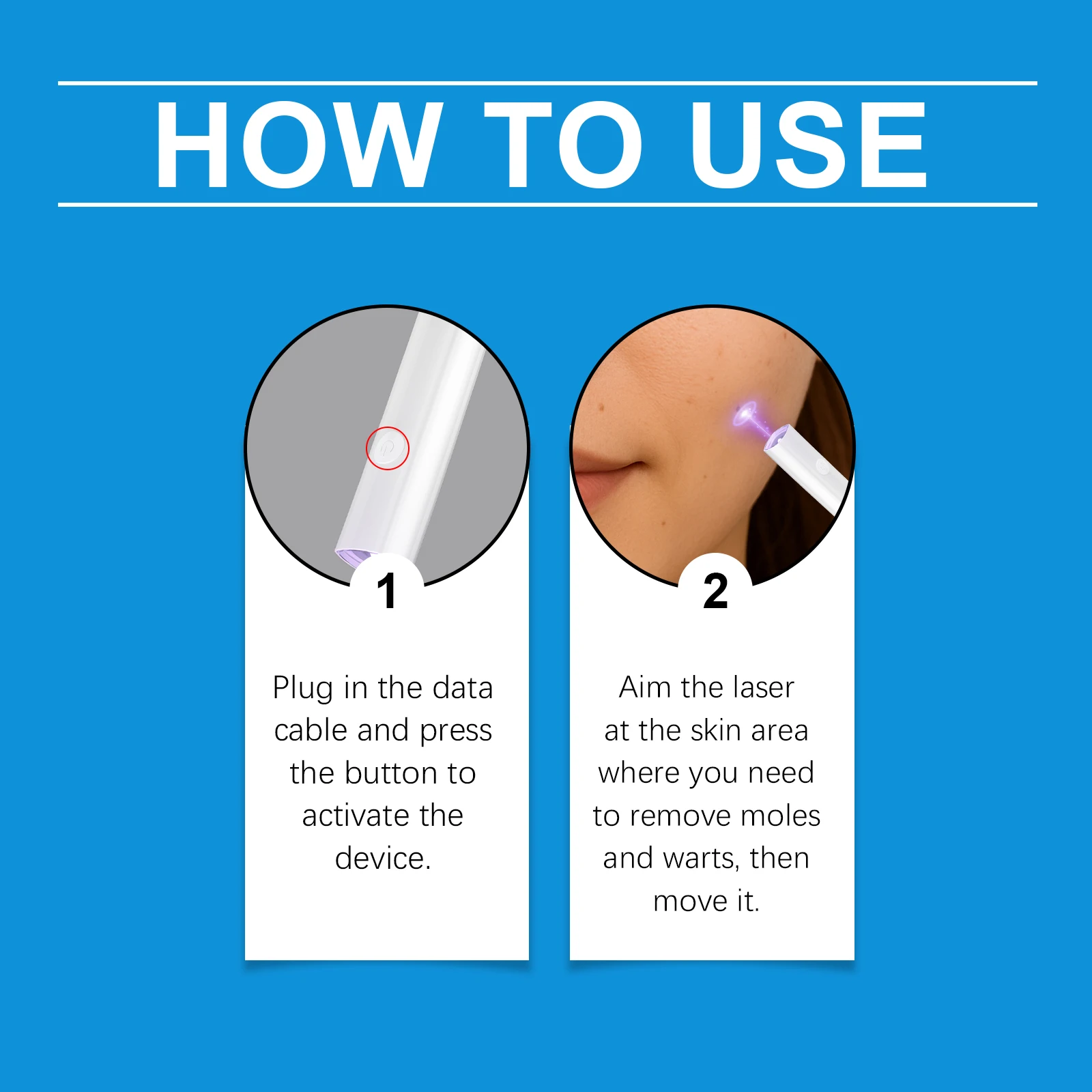 1a SSVerruca aggiornata di generazione riparazione verruche radice uick