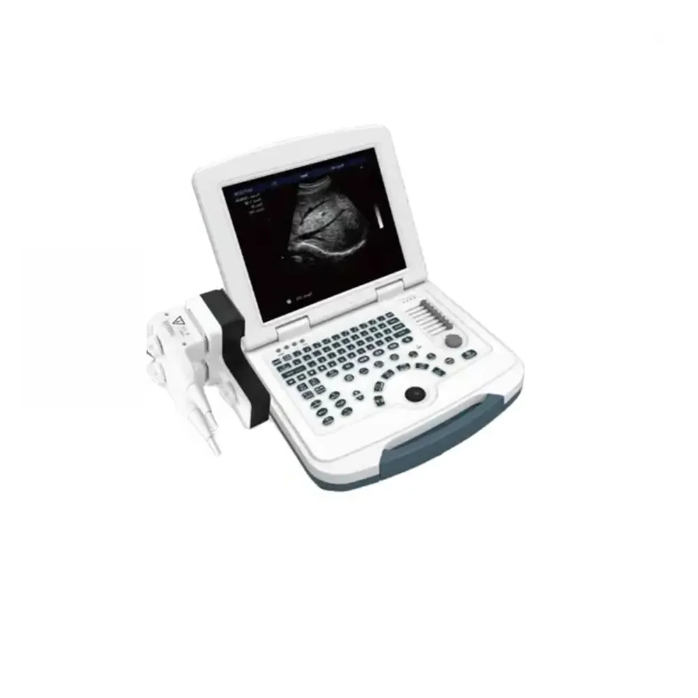 Perfect technology Strong safeguard echographe portable ultrasound scanner wireless probes doppler  15mhz ultrasound scanner