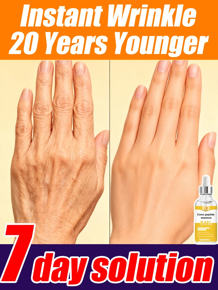 Zmęczone linie zmierzchają i stajesz się bardziej pewny siebie i piękny.