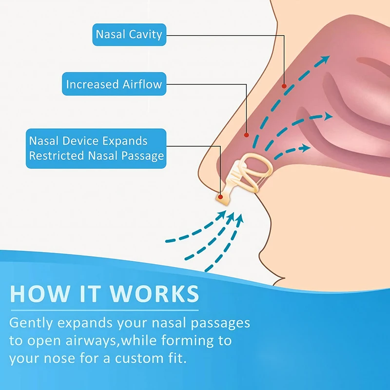 Snore Stopper Nasal Dilator for Snore Reduction Increases Airflow Anti Snoring Devices Silicone Nose Clip Improve Sleep&Snoring