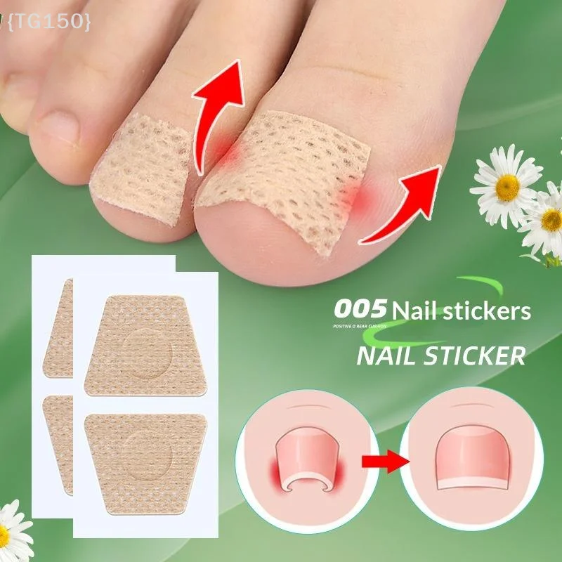 

【TG150】50 Sheets Breathable Non Woven Nail Ingrown Correction Sticker Miracle Tea Tree Oil Nail Patch Suitable For Toenails【WT】
