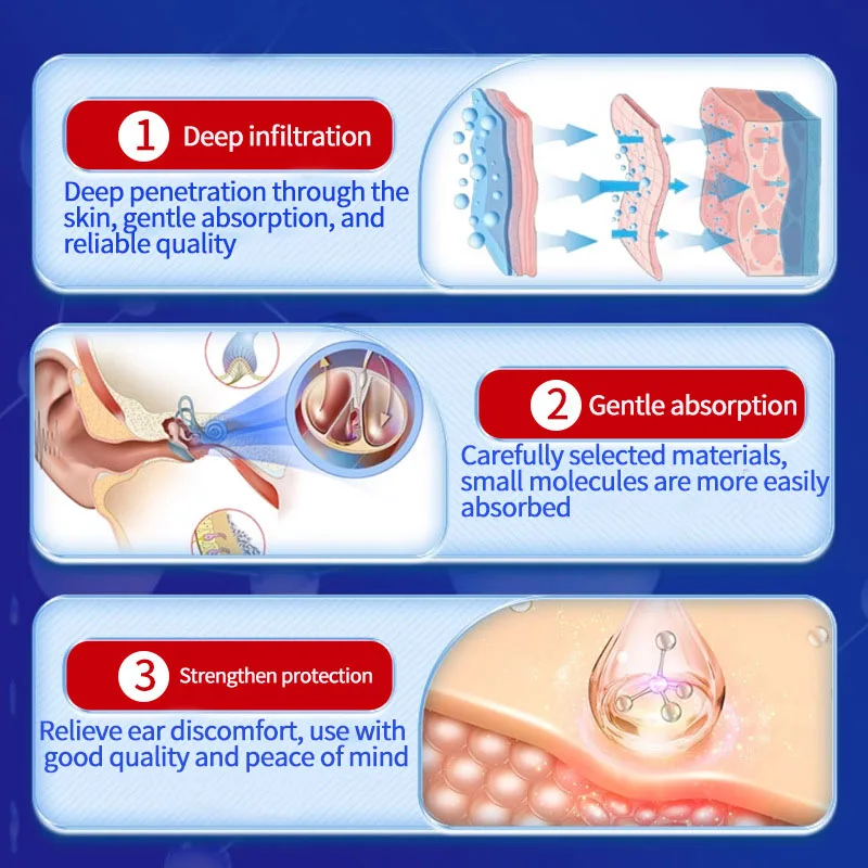 Erkang crema sanitaria esterna 30g, riduzione dell'udito, acufene, prurito all'orecchio, crema per la cura del gonfiore e del disagio