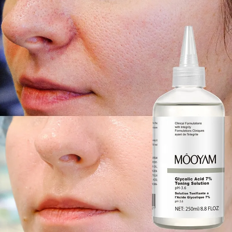 Glycolic Acid 7% Toning Solution Gentle Exfoliation Clear Skin Shrink Pores Acne Removing Brighten Skin Facial Serum