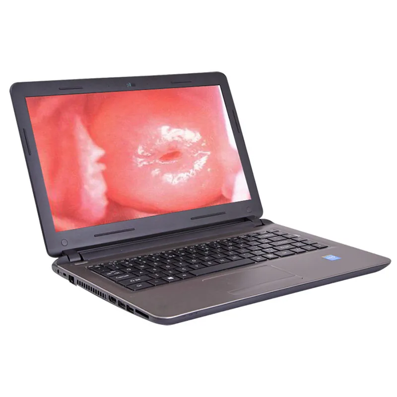 New Optical Video Colpos-cope Medical Device with Laptop Metal and Plastic Electric Power Source