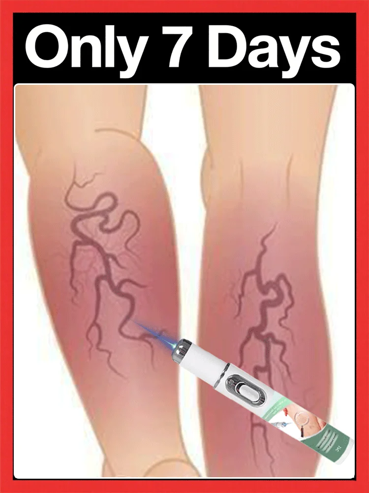 

Laser pen,Protect your health.