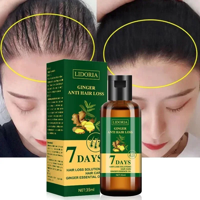 

Ginger Hair Growth Serum Fast Growing Hair Care Oil Anti Hair Loss Baldness Scalp Treatment Repair Damaged Hair for Men Women